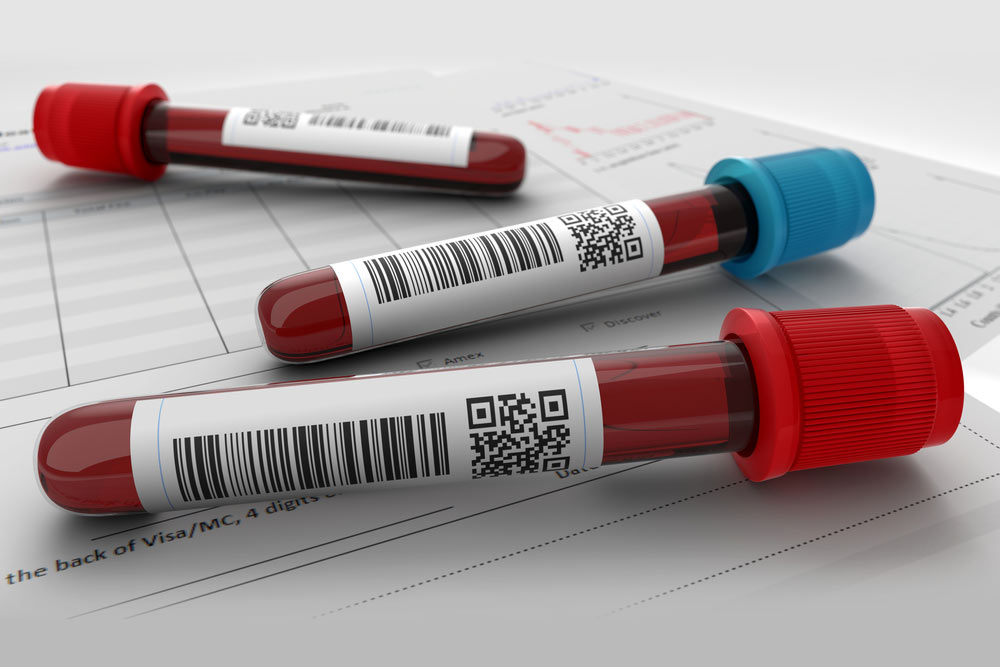 vials of blood showing the concept of Blog